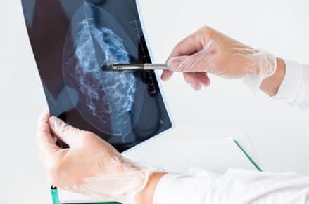 Mammography Test